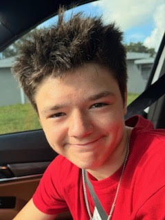 after: the same young man smiling, skin visibly clearer