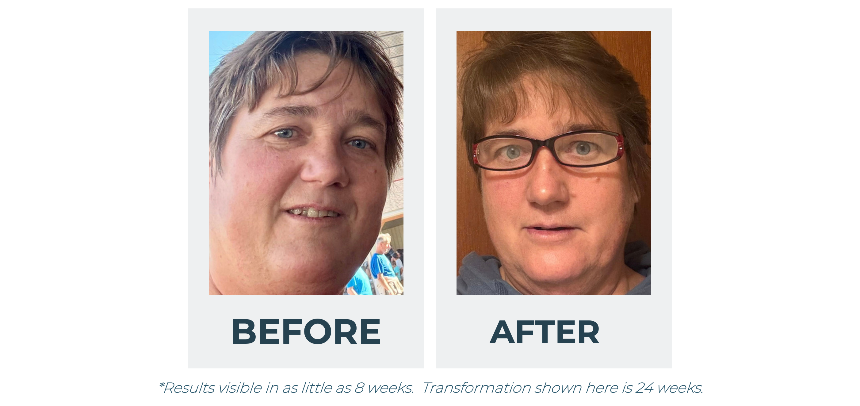 Before and After Face